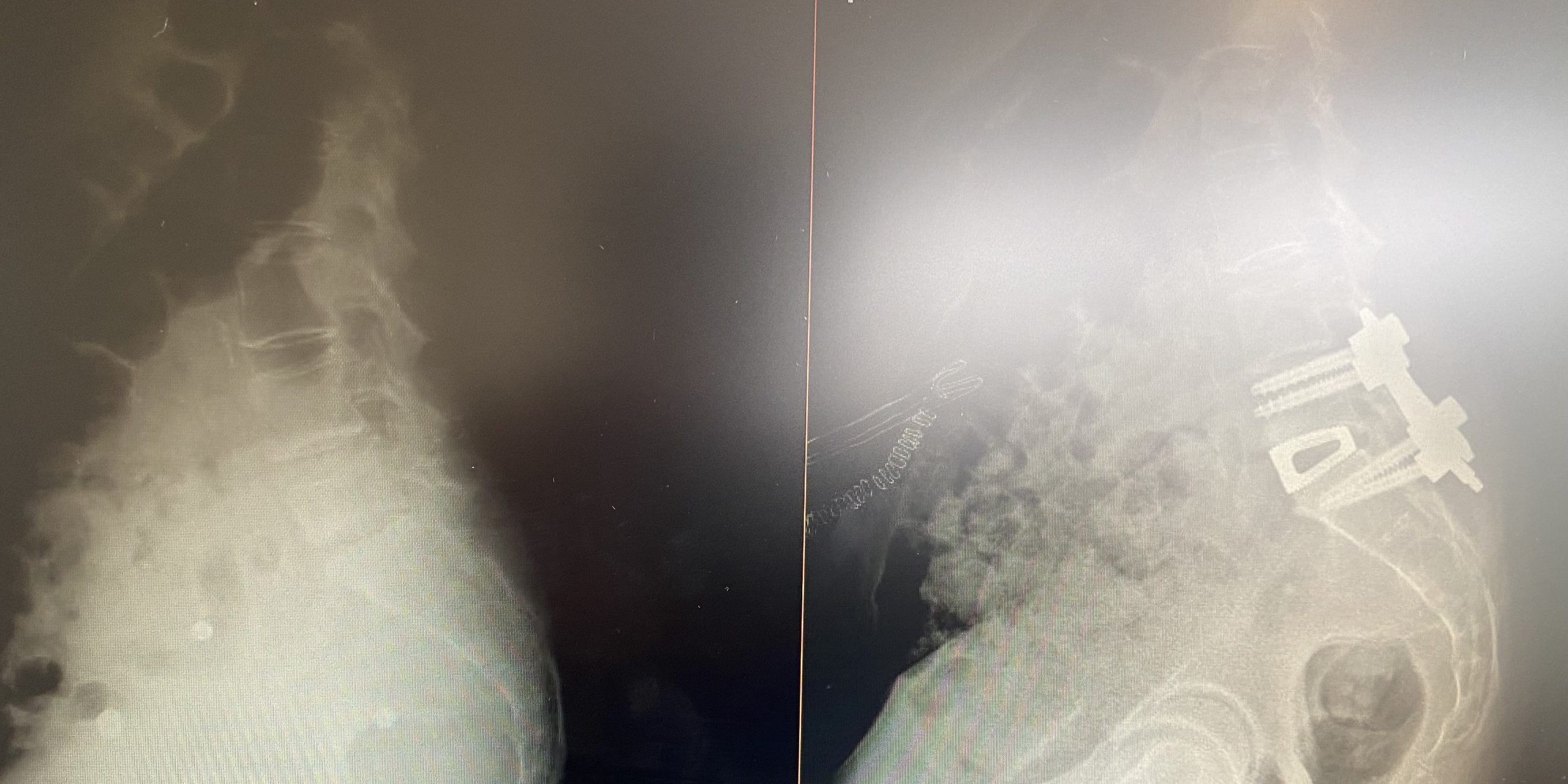 Abordaje anterior del abdomen